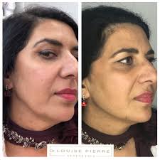 Dr. Louise Pierre Aesthetics