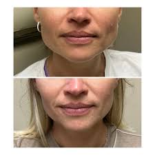 Michael J. Orseck, MD