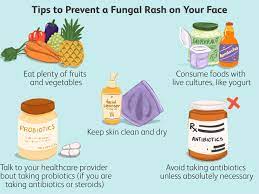 Fungal Rash On The Face: Causes, Treatment, And Prevention
