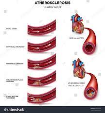 Pin On Heart And Vascular System