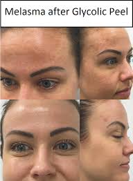 Pin On Beauty Tips