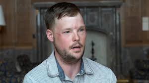 Widow meets man given her dead husband's face in transplant