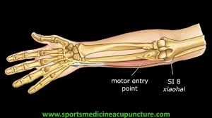 Muscle Motor Points A Focus On Location Acusport Education