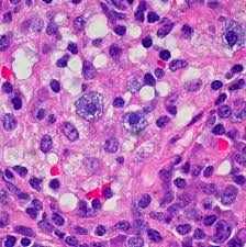Image result for Mast Cell
