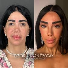 Beautiful one Tricia ): To Fall Asleep, You Must Pretend To Be Asleep  First. And Thats How Everything Works.