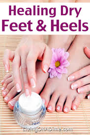 Healing Dry Feet And Cracked Heels - Easy Treatment That Works Fast