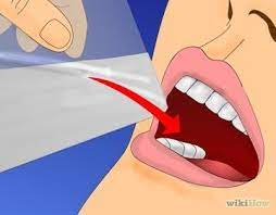 How To Remove Food From Extracted Wisdom Teeth Sockets After Wisdom Teeth Removal Wisdom Teeth Aftercare Wisdom Teeth Food