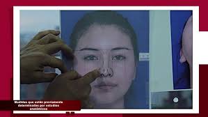 CIRUGÍA PLÁSTICA ESTÉTICA DE NARÍZ, FABIÁN CUEVAS