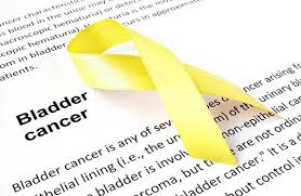 In the early stages of the disease, malignant cancer of the ureter has no symptoms. How Is Bladder Cancer Diagnosed And Treated