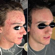 Hey guys, I'm Haley, owner of Freckled Skin Studio Med Spa in Rockwall!  With over 11 years of experience, I'm passionate about helping you achieve  *real* results through science-backed treatments and personalized