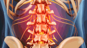 In the lower cavity there is stomach, liver, gallbladder and the intestines. What Really Happens When You Pull A Lower Back Muscle Chiropractors In Boston Ma