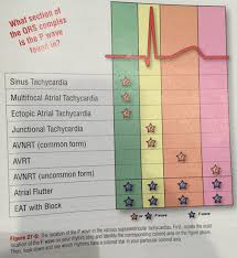 Ekg Interpretation The Best Ekg Books To Read Roshreview Com