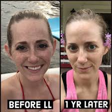 What order should you follow for skincare?