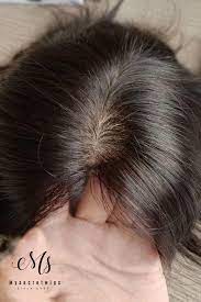 Thinning hair is unfortunately a part of life for the many people as they age. Full Silk Injected Base Human Hair Topper Hair Pieces For Thinning Hair And Baldness Patches Human Hair Pieces Hair Toppers Hairstyles For Thin Hair
