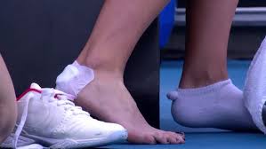 Serena williams managed to win the first set by a whisker against camelia begu in the french open. Irina Camelia Begu S Feet Wikifeet