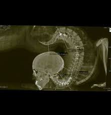 Tumblr Mv0dukx8sa1r9btj0o1 400 Jpg 400 414 Contortionist X Ray Contortion