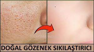 3 Kez Uygula Gozeneklerden Kurtul Dogal Gozenek Sikilastirici Guzel Dogal Akne Tedavisi Cilt Bakimi Tuyolari Ev Yapimi Cilt Bakimi