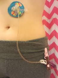 this listing is for 1 one tubie clip tube holder the second picture shows possible pattern placement variation feeding tube tubie hats for cancer patients