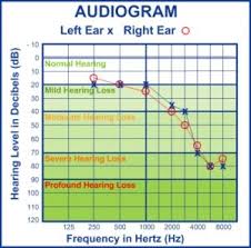 Audiometry is a key tool in uncovering, preventing or treating hearing loss. Pin On Nursing