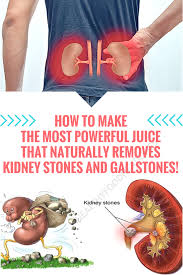 How To Make The Most Powerful Juice That Naturally Removes Kidney Stones And Gallstones Gallstones Whole Body Cleanse Kidney Stones