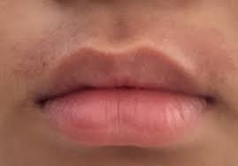 Smooth on cream hair remover, relax for a few minutes and. How To Get Rid Of Upper Lip Burn From Hair Removal Cream Photo