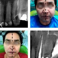Flow chart of patient exclusions.