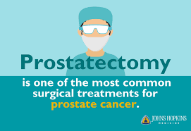 The pancreas is located behind the stomach, so having pancreatic cancer doesn't involve a palpable mass that you can feel. Prostate Cancer Treatment Advances You Should Know About Johns Hopkins Medicine