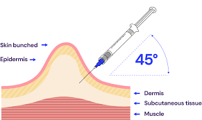 Image result for Subcutaneous Injection
