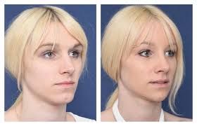 Pin On Mtf Transformation
