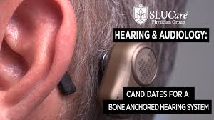 Who is right for a Bone Anchored Hearing System?