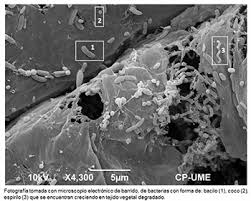 Animales que respiran por la piel. Como Respiran Las Bacterias