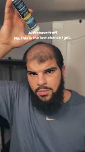 Down to my last lifeline 🥴