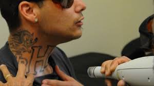 Los angeles ca 90011 (tattoo removal clinic) sccc. Gang Related Tattoo Removal At Homeboy Industries Youtube