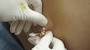 Satisfying Blackhead Popping Gif