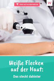 Kleine Weisse Flecken Auf Der Haut Woher Kommen Sie Wunderweib Hautpilz Behandeln Haut Hausmittel Gegen Hautpilz