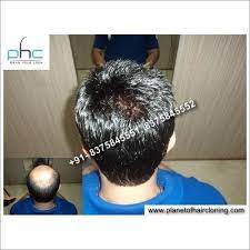 Permanent Hair Fixing Wig Hairstyles Hair Cloning Thin Hair Haircuts
