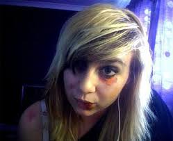 Woman's abusive partner would beat her then kiss her bruises