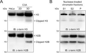 Histone post translational modifications posted by myra sehar in category: Top Down And Middle Down Protein Analysis Reveals That Intact And Clipped Human Histones Differ In Post Translational Modification Patterns S Molecular Cellular Proteomics