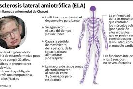 Un ejemplo de supervivencia extraordinario es el de stephen hawking , que vivió más de 50 años con la enfermedad. La Esclerosis Lateral Amiotrofica Una Enfermedad Neurodegenerativa Vanguardia Com