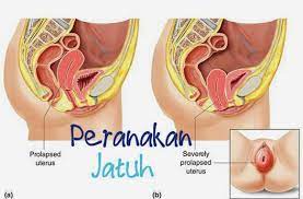 Satu lagi cara untuk mengempiskan perut selepas bersalin adalah dengan anda melakukan diet yang seimbang. Tips Elakkan Peranakan Jatuh Selepas Bersalin