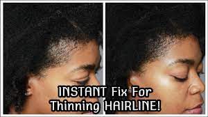 Pin On Natural Hair Share Your Best