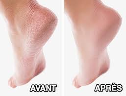 Epingle Sur Beaute
