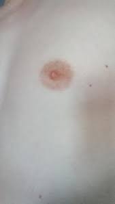 Und schon geht die tube auf! aber erst den nippel durch die lasche zieh'n, und mit der kleinen kurbel ganz nach oben dreh'n. Ist Das Normal Oder Sollte Ich Mir Sorgen Machen Habe Namlich Gelesen Das Es Auch Brustwarzen Mit Unterschiedlichem Aussehen Gibt Gesundheit Manner