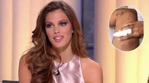 Does iris mittanaere drink alcohol?: Iris Mittenaere Victime D Un Terrible Accident