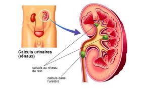 Epingle Sur Sante