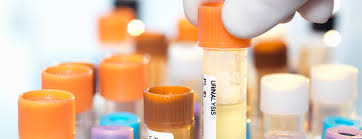 Urinalysis Medical Tests Ucsf Health