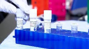 Ontario Reports More Than 1 000 New Novel Coronavirus Cases 44 More Deaths Cp24 Com