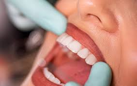 Image result for dental cancer