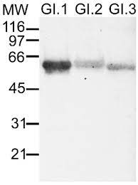 You have the choice between the common skin tones like black or white. Microorganisms Free Full Text A Review On The Methods Used For The Detection And Diagnosis Of Rabbit Hemorrhagic Disease Virus Rhdv Html