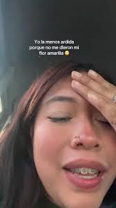 Yo La Menos Ardida Flores Amarillas